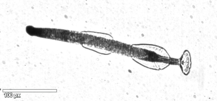 Cropped plankton region of interest with scale bar.